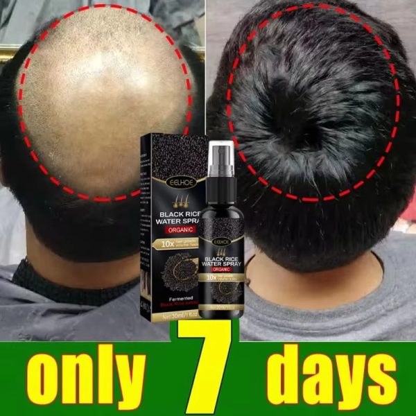 Black Rice Fast Hair Growth Serum Spray for Men Women Anti-loss Hair Regrowth Essential Oil-used-mobile-photo-bangladesh-buy-sale-exchange-shop