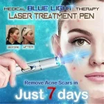Facial Beauty Device Eye Massager Blue Light Black Eye (New)