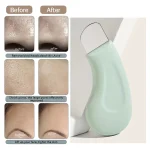 Deep Cleansing Blackhead and Whitehead Removal Tool for Nose (New)