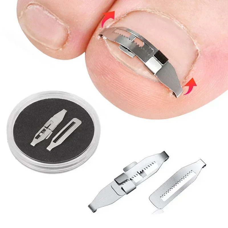 S2bec729926754850975cd778ba312118K Ingrown Toenail Corrector Tools Pedicure Recover Embed Toe Nail Treatment Professional Ingrown Toenail (New) - Image 1