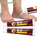 2 Varicose Vein Ointment Treat Phlebitis Vasculitis Cream Leg Vein Removal Swelling Pain (New)