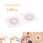 10 Anti Leakage Ring For Colostomy Bag Ostomy Paste Ring Baseplates Stoma Care Products (New)