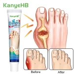 1 Foot Gout Treatment Cream Thumb Corrector Finger Hallux Ointment Toe Bunion Pain (New)