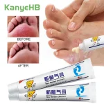 2 Tinea Pedis Cream Inhibit Fungi Remove Foot Odor Herbal Medical Beriberi Ointment (New)