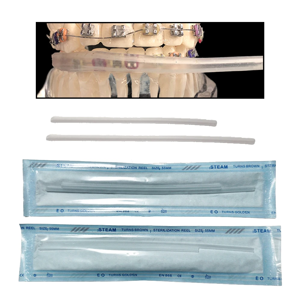 S9351878f32c648ac84a15143bd822b668 1 Set of Transparent Orthodontic Cheek Tube Protective Cover, Comfortable Lip Guard Tooth Guard (New) - Image 1
