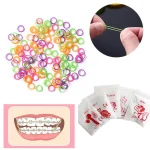 100 dental colored elastic latex rings, braces, dental rubber bands, non toxic material 3.5OZ (New)