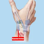 1 Thumb Brace Wrist Stabilizer Pain Relief Right Or Left Hand Soft Thumb (New)