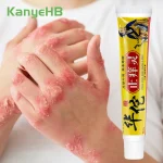 1 Psoriasis Cream Skin Anti Itch Eczema Dermatitis Psoriasis Treatment Ointment Health Care (New)