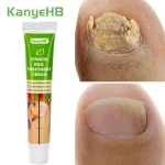 1 Nail Fungal Treatment Ointment Anti Infection Paronychia Onychomycosis Foot Toe Nail Fungus (New)