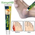 1 Gout Treatment Cream Finger Toe Bunion Joint Pain Relief Herbal Medical Cream (New)