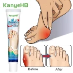 1 Gout Medicine Cream Arthritis Pain Relief Health Care Herbal Treatment Rheumatism Joint (New)