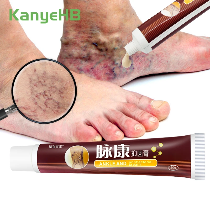 Se161a32ef3cc4ff09823828cf79bbb16h 1 Varicose Veins Treatment Cream Remove Red Blood Streaks Varicocele Vasculitis Phlebitis Strengthen (New) - Image 1